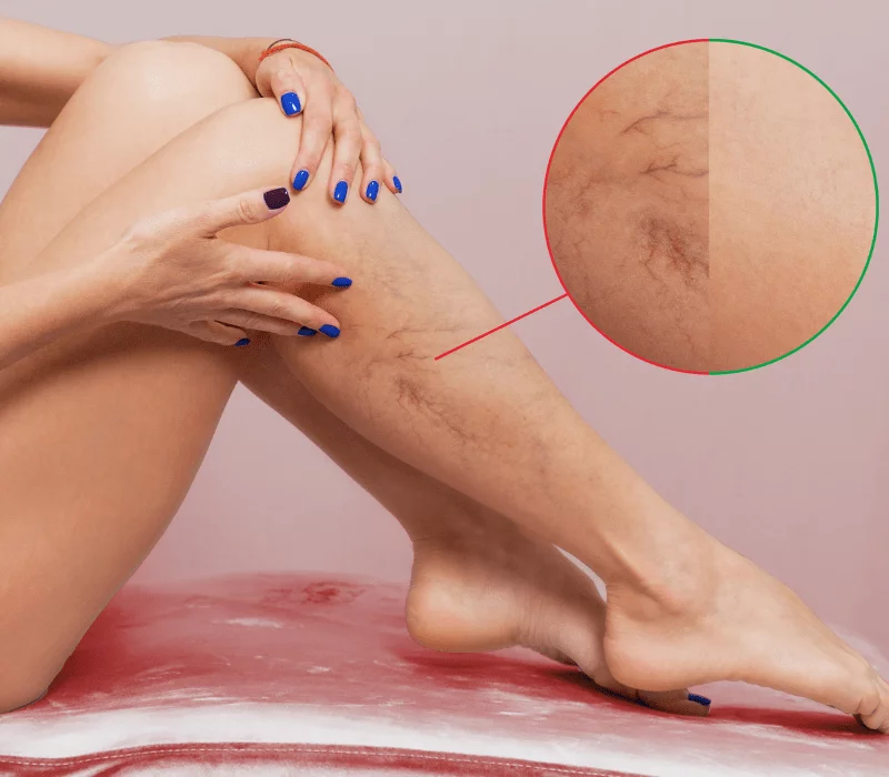 Obrazek posiada pusty atrybut alt; plik o nazwie Zylaki-CmsCode-Lodz-1.png