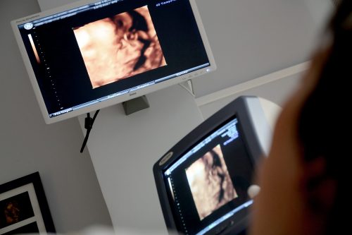 Badanie USG ciąży